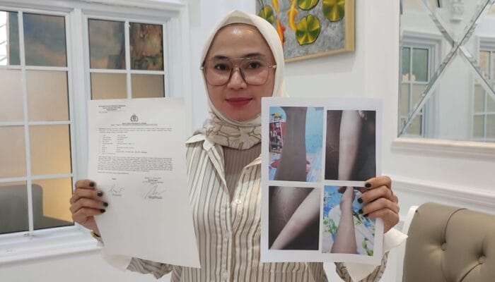 Laporan Korban Dugaan KDRT di Bangka, Akhirnya Terbit, Kuasa Hukum : Sudah Berlangsung dari Oktober 2023