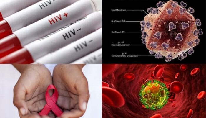 53 orang Warga Beltim Terinfeksi Virus HIV/AIDS, 24 Diantaranya Positif Didominasi Laki-Laki